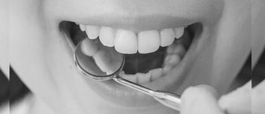 Soñar con dientes picados puede tener diversos significados que dependerá de los detalles que recuerdes. ¿Sabes que significan los dientes picados en tus sueños?