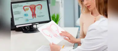 ¿Cómo saber si tienes quistes en los ovarios? ¿Cómo saber si tienes quistes en los ovarios?