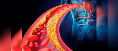 ¿Cómo saber si tienes un problema de arterias? Estas son las señales ¿Cómo saber si tienes un problema de arterias? Estas son las señales