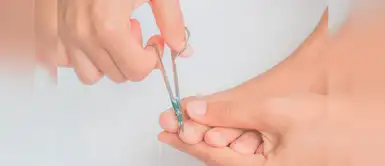 ¿Tienes uñero y no puedes sacarlo? Estos remedios caseros podrían ser la solución ¿Tienes uñero y no puedes sacarlo? Estos remedios caseros podrían ser la solución