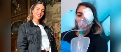 Pterigión: qué es, causas y más de la operación a la que se sometió Korina Rivadeneira Pterigión: qué es, causas y más de la operación a la que se sometió Korina Rivadeneira