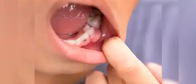 ¿Cómo evitar la caries en los niños? Añade estos superalimentos en su dieta ¿Cómo evitar la caries en los niños? Añade estos superalimentos en su dieta