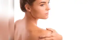 ¿Quieres borrar alguna cicatriz? Prueba estas cremas caseras a base de coco ¿Quieres borrar alguna cicatriz? Prueba estas cremas caseras a base de coco