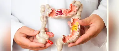 Síndrome del colon irritable: ¿se puede tratar y aliviar los síntomas sin medicamentos? Síndrome del colon irritable: ¿se puede tratar y aliviar los síntomas sin medicamentos?