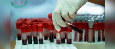 ¡Increíble! Científicos crean sangre artificial para cualquier grupo sanguíneo ¡Increíble! Científicos crean sangre artificial para cualquier grupo sanguíneo