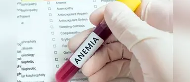 Día Mundial del Alimentación: Conoce las vitaminas que te ayudan a combatir la anemia Día Mundial del Alimentación: Conoce las vitaminas que te ayudan a combatir la anemia