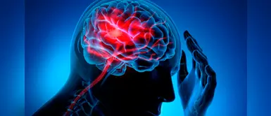 Accidente Cerebrovascular: ¿Sabías que es la segunda causa de muerte en el Perú? Accidente Cerebrovascular: ¿Sabías que es la segunda causa de muerte en el Perú?