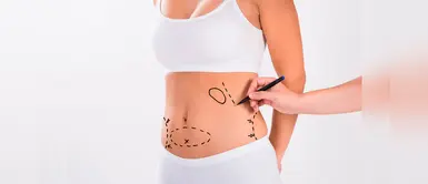 ¿Qué debes tener en cuenta antes de hacerte una liposucción? Sigue estos consejos ¿Qué debes tener en cuenta antes de hacerte una liposucción? Sigue estos consejos