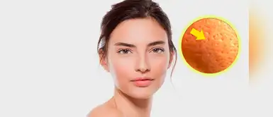 ¿Poros dilatados? Con estas dos mascarillas las eliminarás ¿Poros dilatados? Con estas dos mascarillas las eliminarás