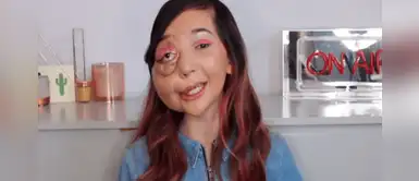 Nikki Lilly: la youtuber que sufre malformación y es un ejemplo para muchos Nikki Lilly: la youtuber que sufre malformación y es un ejemplo para muchos