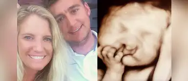 Padres se negaron a abortar a su bebé con malformación y hoy es feliz tras cirugías Padres se negaron a abortar a su bebé con malformación y hoy es feliz tras cirugías