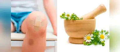 ¿Sabías que la manzanilla ayuda a cicatrizar las heridas? ¿Sabías que la manzanilla ayuda a cicatrizar las heridas?