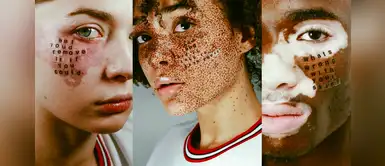 ¡Impresionante! La campaña que te animará a dejar de lado todos tus complejos ¡Impresionante! La campaña que te animará a dejar de lado todos tus complejos