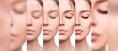 Aprende a hacer un maquillaje anti-imperfecciones y realza tu hermosura Aprende a hacer un maquillaje anti-imperfecciones y realza tu hermosura