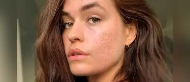 Mandamientos para aprender a aceptar tus 'imperfecciones' en la piel Mandamientos para aprender a aceptar tus 'imperfecciones' en la piel