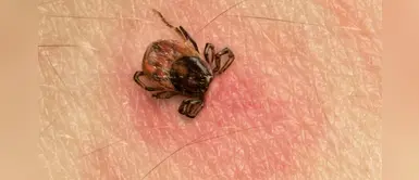 ¿Cuál es la mejor manera de extraer una garrapata? ¿Cuál es la mejor manera de extraer una garrapata?