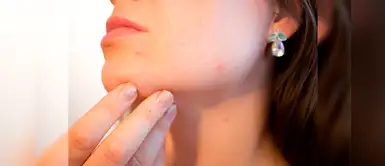 Estas son las enfermedades de la piel más comunes causadas por el estrés Estas son las enfermedades de la piel más comunes causadas por el estrés