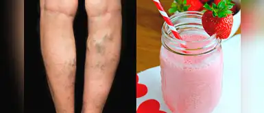 ¿Cómo detener la aparición de várices? Consíguelo con unos deliciosos batidos ¿Cómo detener la aparición de várices? Consíguelo con unos deliciosos batidos