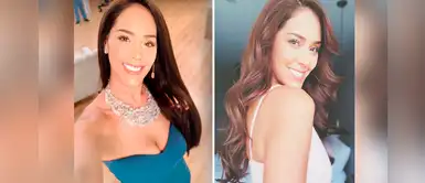 Revelan fotos de Karen Schwarz antes de sus cirugías Revelan fotos de Karen Schwarz antes de sus cirugías