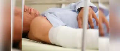 Cómo actuar frente a una persona con quemaduras Cómo actuar frente a una persona con quemaduras