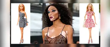 Barbie: Muñecas con vitíligo y sin cabello fortalecen diversidad femenina Barbie: Muñecas con vitíligo y sin cabello fortalecen diversidad femenina