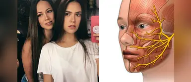 Parálisis facial: Qué es, causas, síntomas y más sobre el mal que sufrió hija de Melissa Klug Parálisis facial: Qué es, causas, síntomas y más sobre el mal que sufrió hija de Melissa Klug