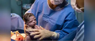 Recién nacida nace 'enojada' y se vuelve viral en Redes Sociales Recién nacida nace 'enojada' y se vuelve viral en Redes Sociales