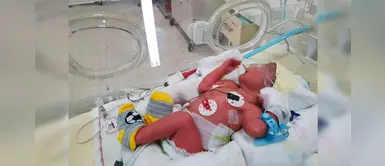 INSN: Fuerte ruido de vehículos afecta la salud de los pacientes INSN: Fuerte ruido de vehículos afecta la salud de los pacientes