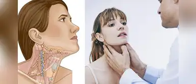 Ganglios linfáticos: ¿Qué es ese bulto que está en el cuello? Ganglios linfáticos: ¿Qué es ese bulto que está en el cuello?