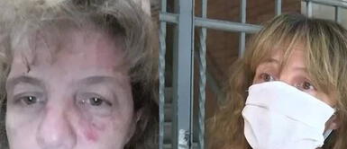 Enfermera es golpeada y bañada con desinfectante en la puerta de su hogar por su vecino Enfermera es golpeada y bañada con desinfectante en la puerta de su hogar por su vecino