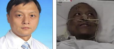 Médicos que sobrevivieron al coronavirus en China experimentan extraño cambio de color de piel Médicos que sobrevivieron al coronavirus en China experimentan extraño cambio de color de piel