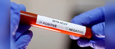 Coronavirus en Perú: Se elevó a 42,534 los casos de COVID-19 en territorio nacional Coronavirus en Perú: Se elevó a 42,534 los casos de COVID-19 en territorio nacional