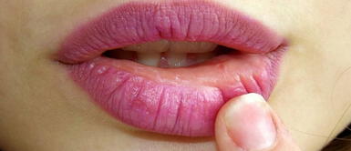 Labios resecos: Claves para evitarlo y los mejores ingredientes para humectarlos Labios resecos: Claves para evitarlo y los mejores ingredientes para humectarlos