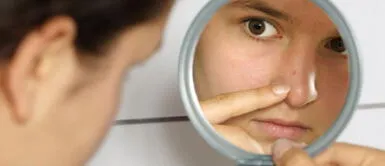 Granos en el rostro: Bicarbonato de sodio y limón para ponerle fin a las impurezas Granos en el rostro: Bicarbonato de sodio y limón para ponerle fin a las impurezas