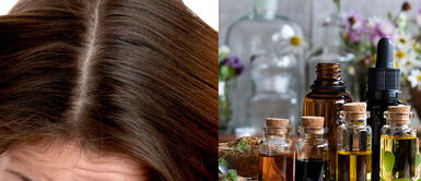 ¿Cómo aliviar de forma natural la picazón en el cuero cabelludo? ¿Cómo aliviar de forma natural la picazón en el cuero cabelludo?