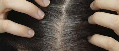 ¿Por qué el estrés provoca la aparición de canas? Científicos descubren la causa y posible remedio ¿Por qué el estrés provoca la aparición de canas? Científicos descubren la causa y posible remedio