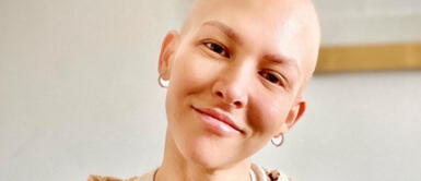 Anahí de Cárdenas ante el cáncer de mama: "Solo dos quimios más y estoy libre" Anahí de Cárdenas ante el cáncer de mama: "Solo dos quimios más y estoy libre"