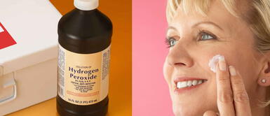 ¿Cómo usar agua oxigenada para eliminar las manchas en la cara y aclarar el cabello? ¿Cómo usar agua oxigenada para eliminar las manchas en la cara y aclarar el cabello?