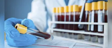 Coronavirus: Anticuerpos generados por neumonía viral podrían neutralizan al COVID-19 Coronavirus: Anticuerpos generados por neumonía viral podrían neutralizan al COVID-19