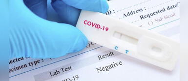 #BuenasNoticias: Científicos peruanos trabajan en kits de diagnóstico de COVID-19 #BuenasNoticias: Científicos peruanos trabajan en kits de diagnóstico de COVID-19