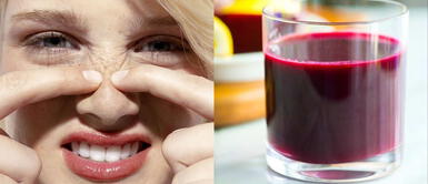 Despídete de los brotes de acné y las manchas con este tratamiento de beterraga Despídete de los brotes de acné y las manchas con este tratamiento de beterraga