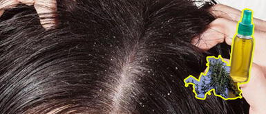 Remedio casero: tomillo para eliminar la caspa y algo más Remedio casero: tomillo para eliminar la caspa y algo más