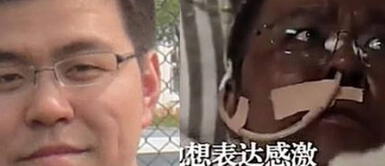 ¡No pudo contra el coronavirus! Fallece doctor chino que sufrió cambio en color de piel ¡No pudo contra el coronavirus! Fallece doctor chino que sufrió cambio en color de piel