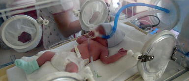 Bebé que nació con COVID-19 logra recuperarse con transfusión de plasma Bebé que nació con COVID-19 logra recuperarse con transfusión de plasma