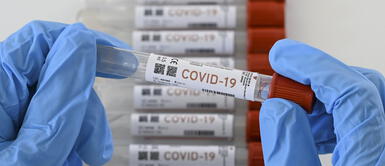 #BuenasNoticias: En un mes estarán listas pruebas moleculares hechas en Perú #BuenasNoticias: En un mes estarán listas pruebas moleculares hechas en Perú