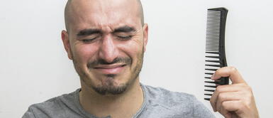 ¿Sabías que los hombres calvos podrían tener mayor riesgo de ser hospitalizados por COVID-19? ¿Sabías que los hombres calvos podrían tener mayor riesgo de ser hospitalizados por COVID-19?