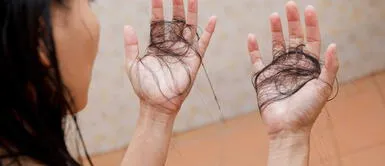 ¿Notas que se te cae demasiado cabello en la cuarentena? Te revelamos la razón ¿Notas que se te cae demasiado cabello en la cuarentena? Te revelamos la razón