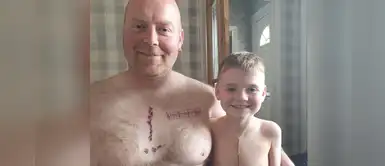 Papá se tatuó la misma cicatriz de su hijo que fue operado del corazón para que no se avergonzara Papá se tatuó la misma cicatriz de su hijo que fue operado del corazón para que no se avergonzara