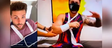 Nicola Porcella se rompió los tríceps: ¿Qué gravedad tiene y en cuánto tiempo se recuperará? Nicola Porcella se rompió los tríceps: ¿Qué gravedad tiene y en cuánto tiempo se recuperará?