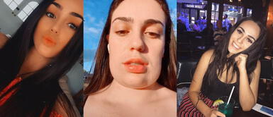 Joven se aplica tratamiento para quitarse la papada y acaba con el rostro deforme Joven se aplica tratamiento para quitarse la papada y acaba con el rostro deforme